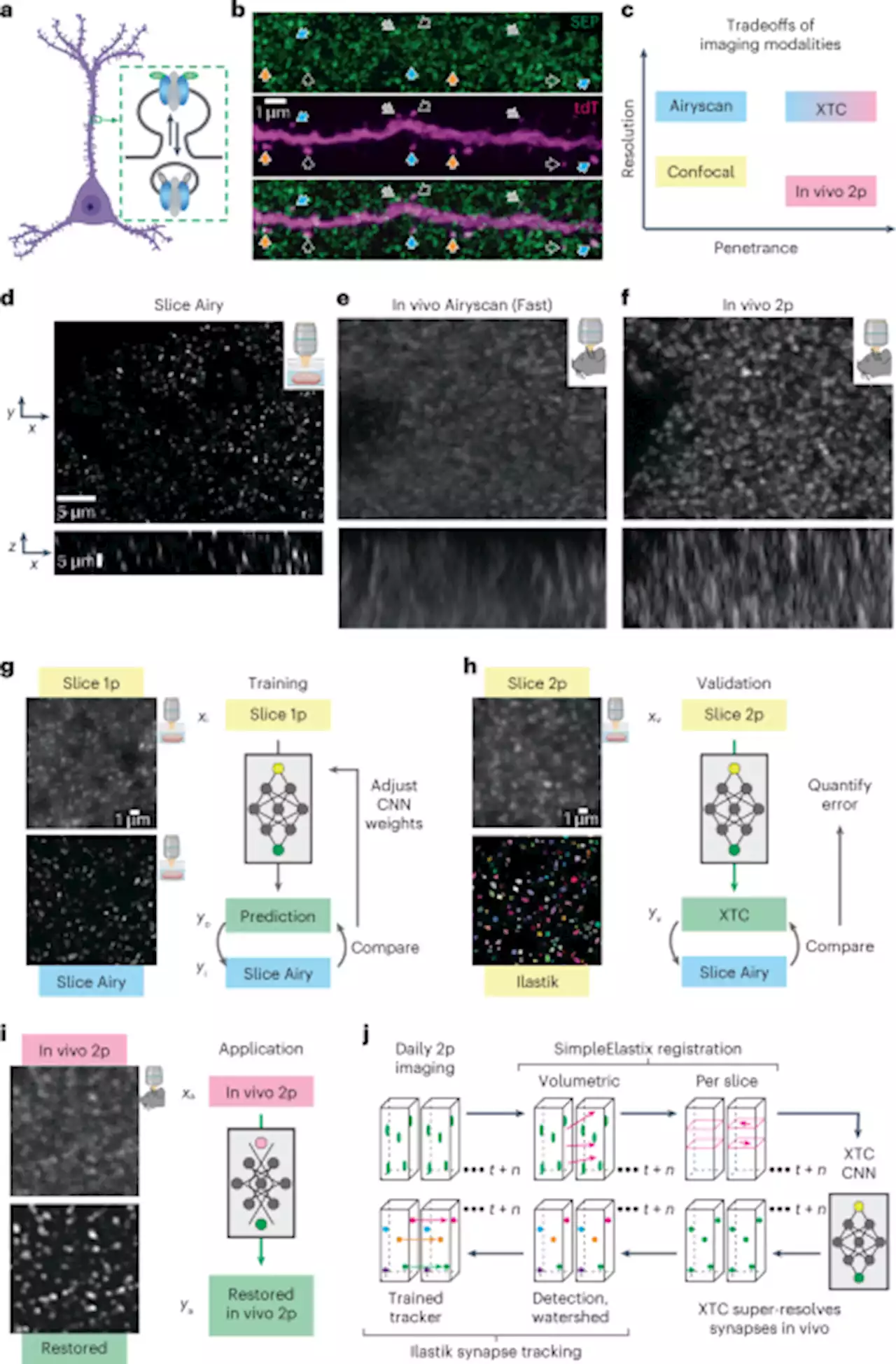 Cross-modality supervised image restoration enables nanoscale tracking of synaptic plasticity in living mice - Nature Methods