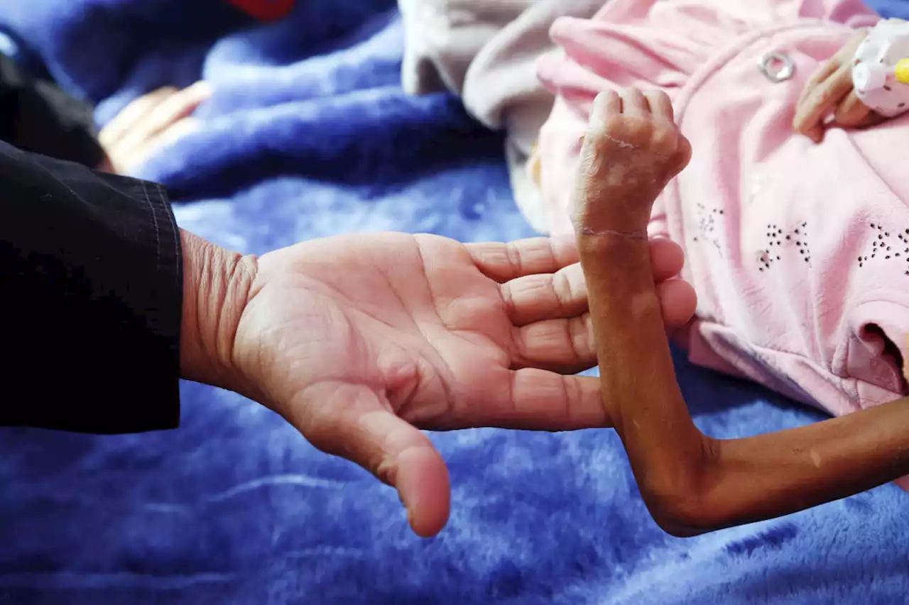 More than a quarter of a billion people faced severe hunger in 2022