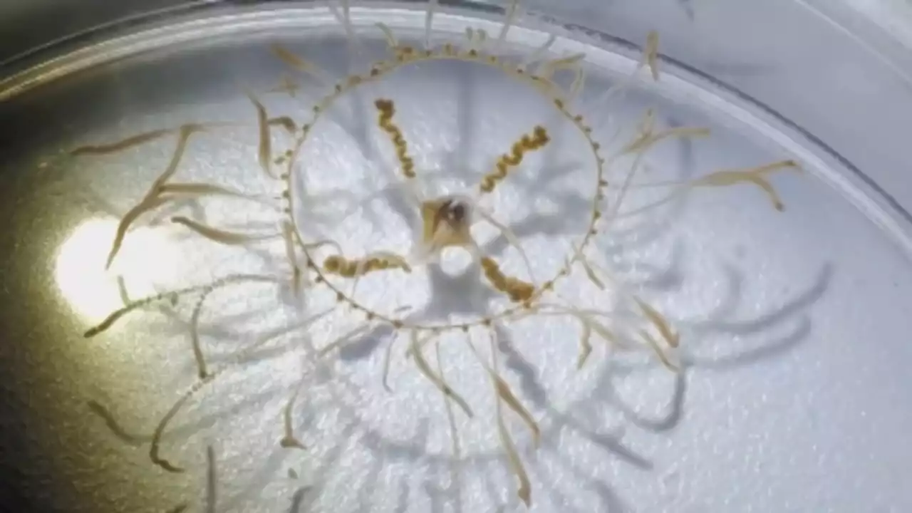 Clinging jellyfish could be lurking at the Jersey shore, marine expert warns