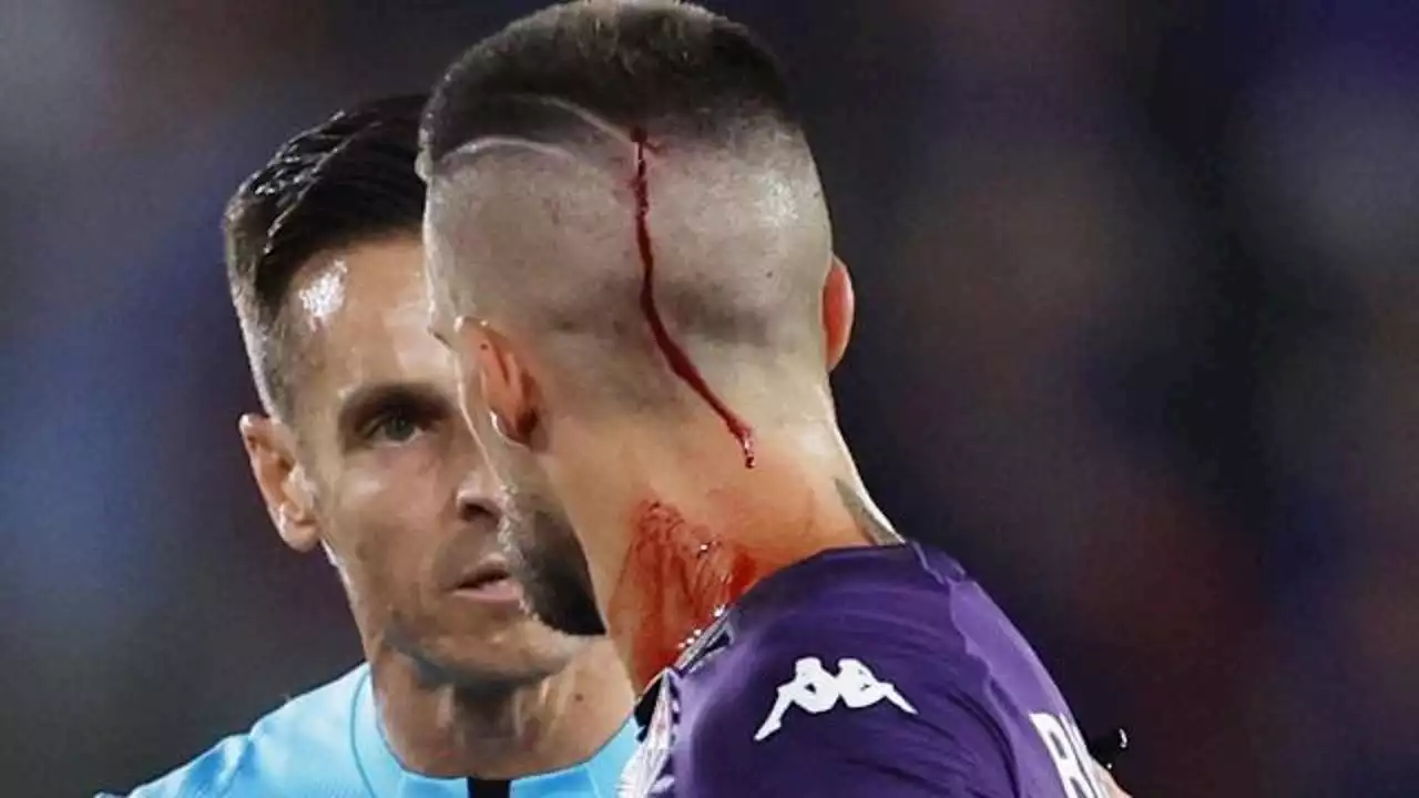 Cristiano Biraghi della Fiorentina colpito in testa da un oggetto lanciato dai tifosi del West Ham