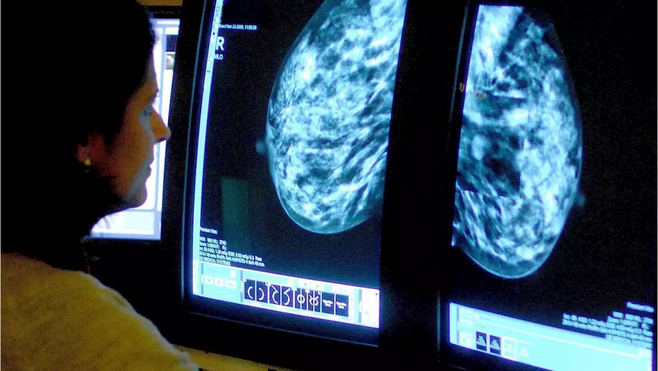 Cancer care pushed ‘to the brink of disaster’ due to NHS staff shortages, charity leaders warn