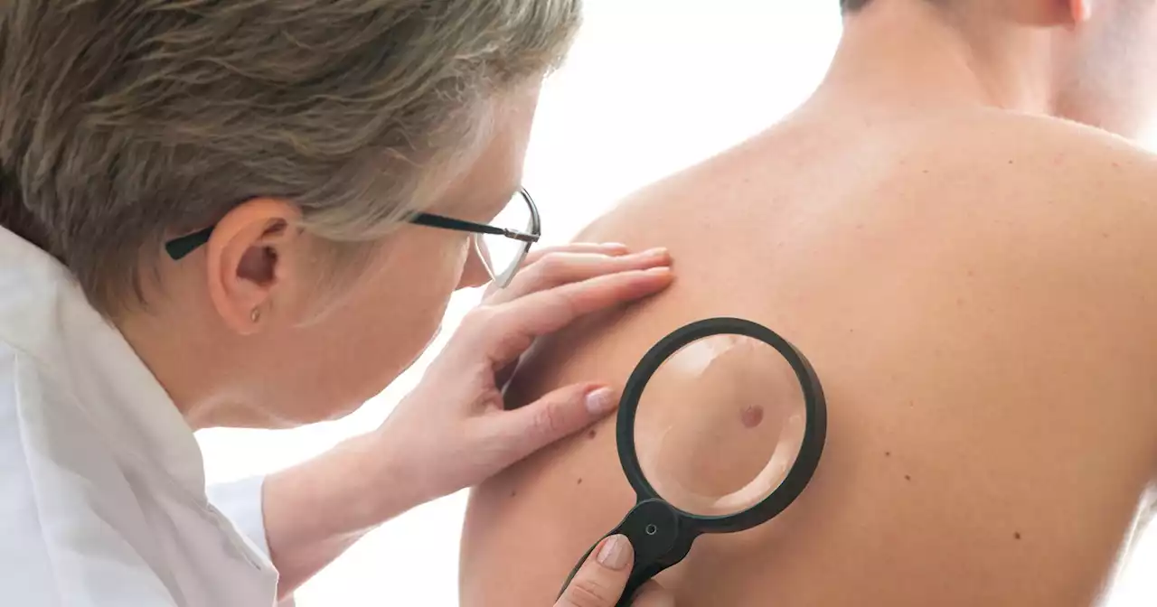 New Smartphone Camera Lens to Help Easily Diagnose Skin Cancer