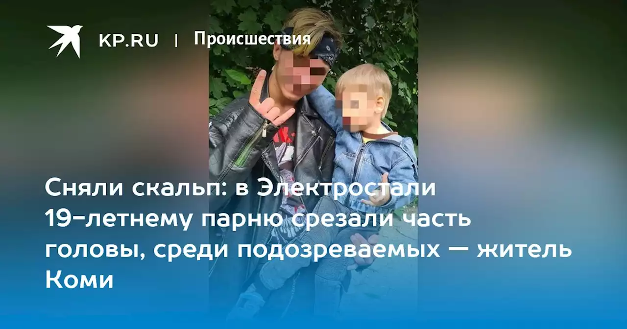 Сняли скальп: в Электростали 19-летнему парню срезали часть головы, среди подозреваемых — житель Коми