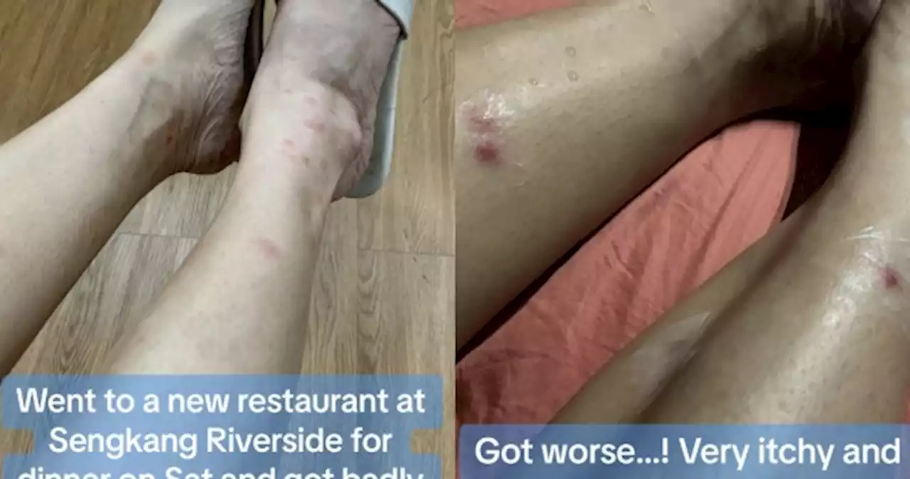 'Now left with ugly scars': Diner badly bitten by sandflies after dining at Sengkang restaurant