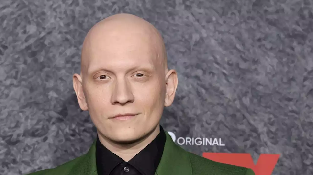 ‘Superman: Legacy’ Adds ‘Barry’s Anthony Carrigan To Cast