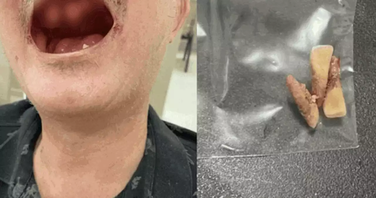 Uncle loses teeth after brawl with couple over baby stroller in Tampines One lift