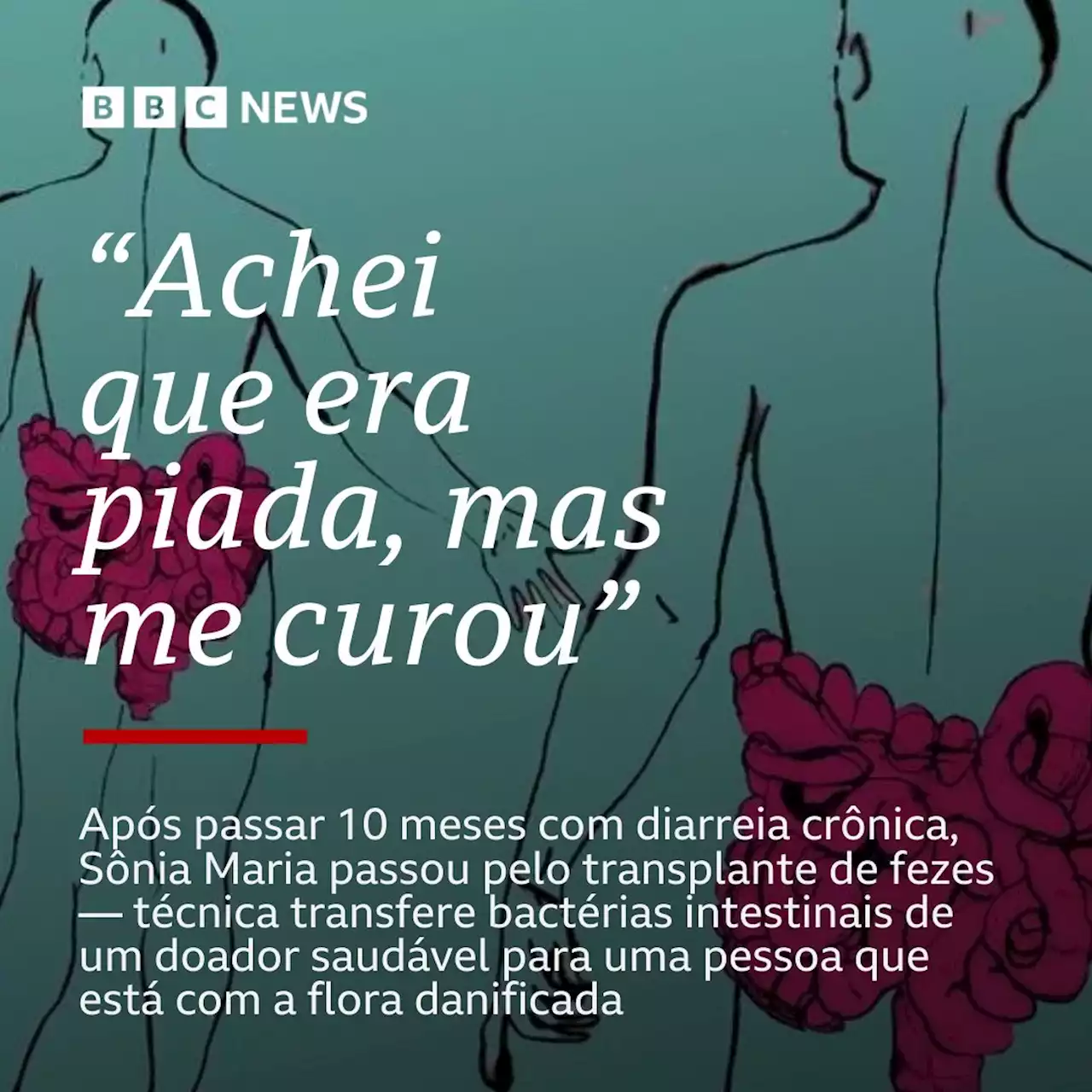 'Transplante de fezes curou inflamação que me causava diarreia crônica há 10 meses' - BBC News Brasil