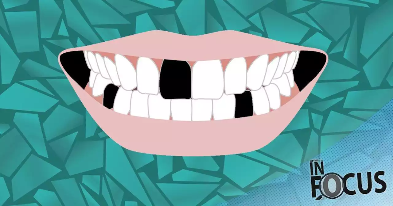 ‘I pulled out five of my teeth’: The rise of DIY dentistry