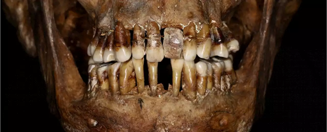 This 17th-Century Aristocrat Had a Crafty Secret For Keeping Her Teeth