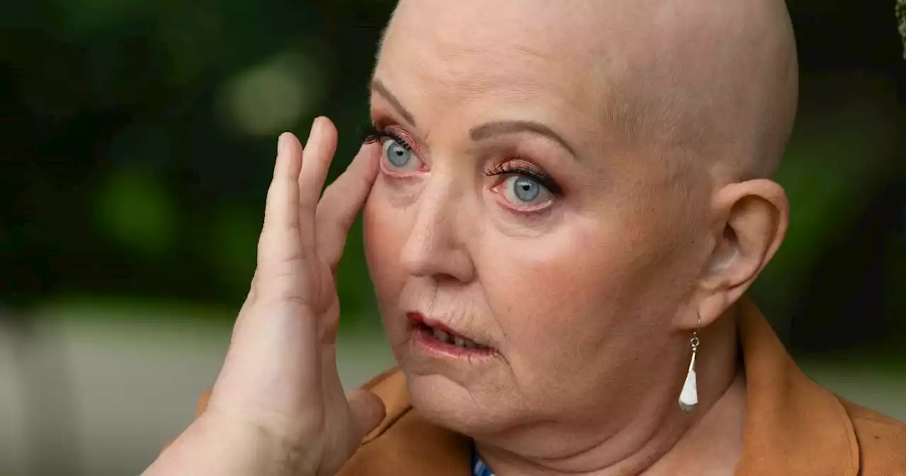 Tearful Linda Nolan's confession as incurable cancer spreads to her brain