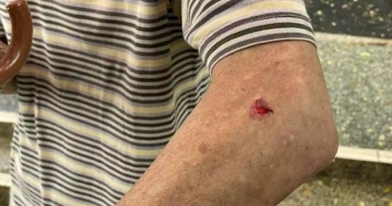 Man hit by car, father scratched after scuffle with taxi driver over rude hand gesture