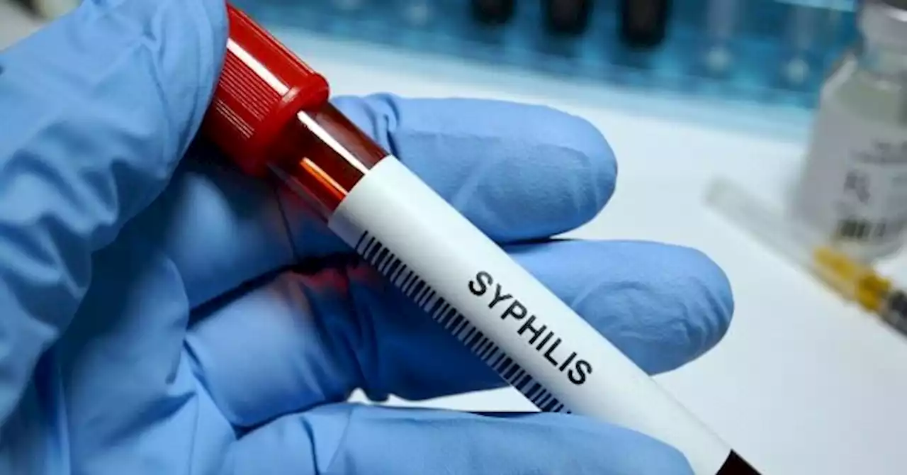 'Millions May Be at Risk': Houston Hit with 'Alarming' Syphilis Outbreak