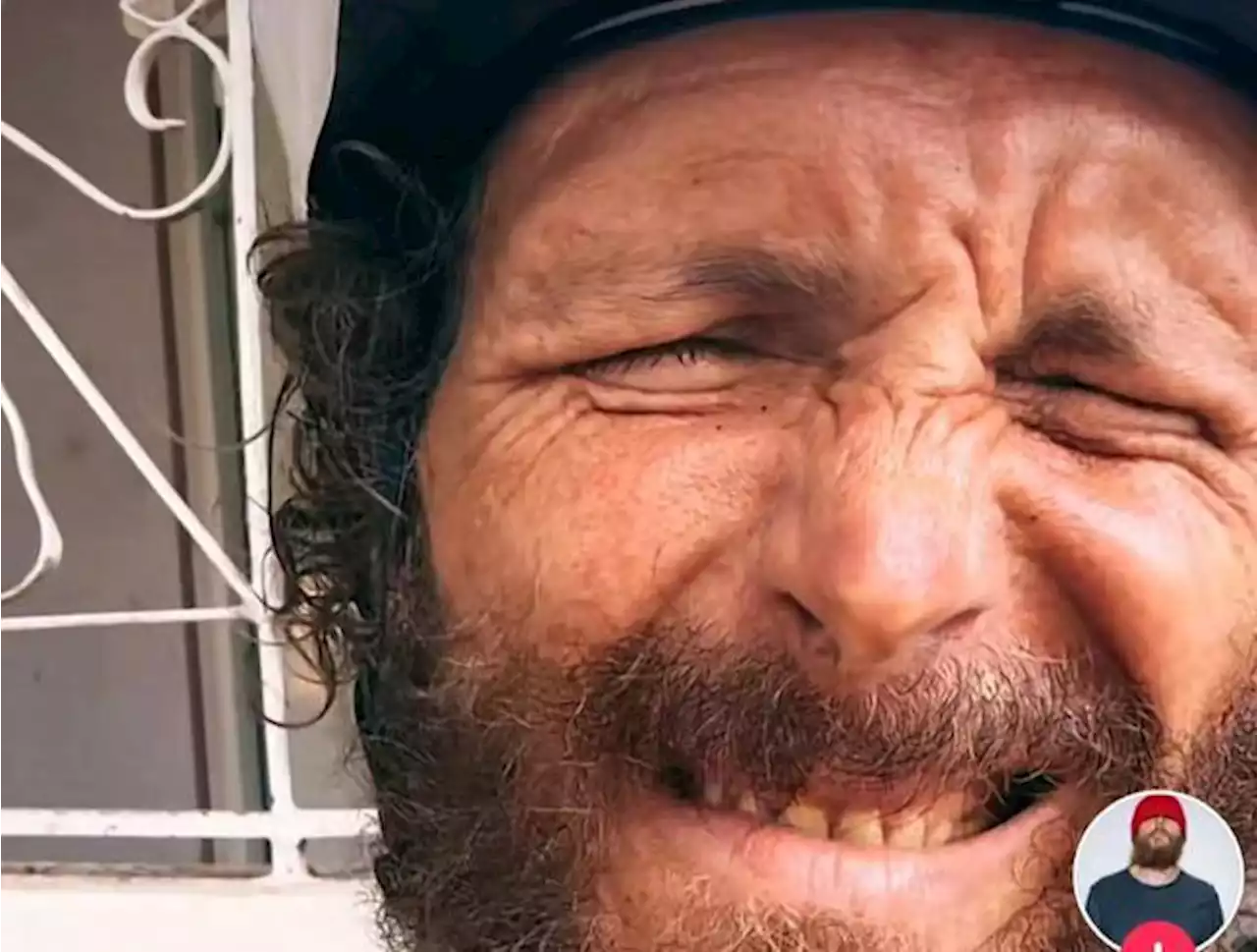 Jovanotti, incidente in bici