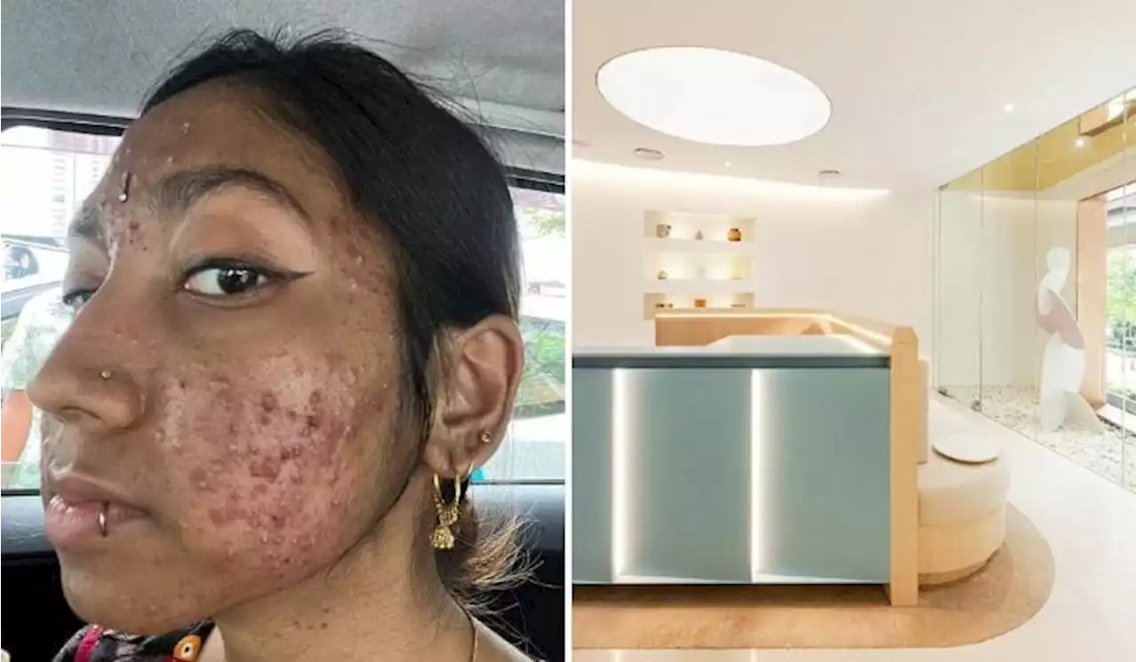 Malaysian Woman Claims Facial Treatments Ruined Her Skin, Venusde Says It Isn’t True | TRP