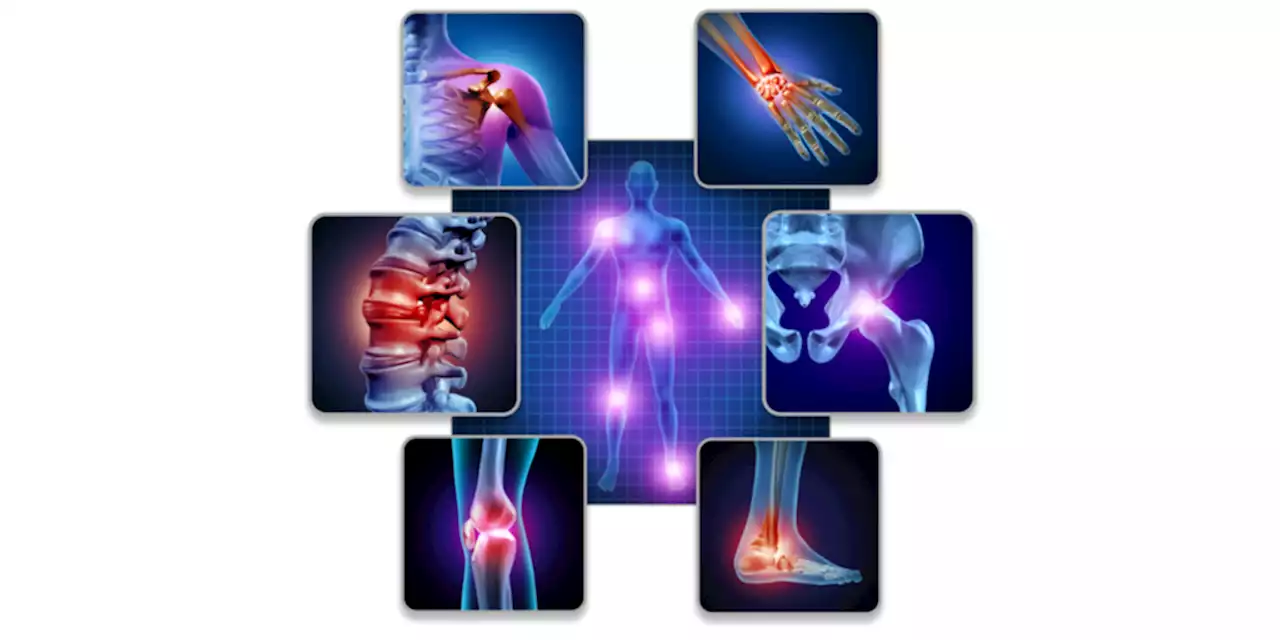 Antidrug Antibody Effects Compared Across RA Biologics