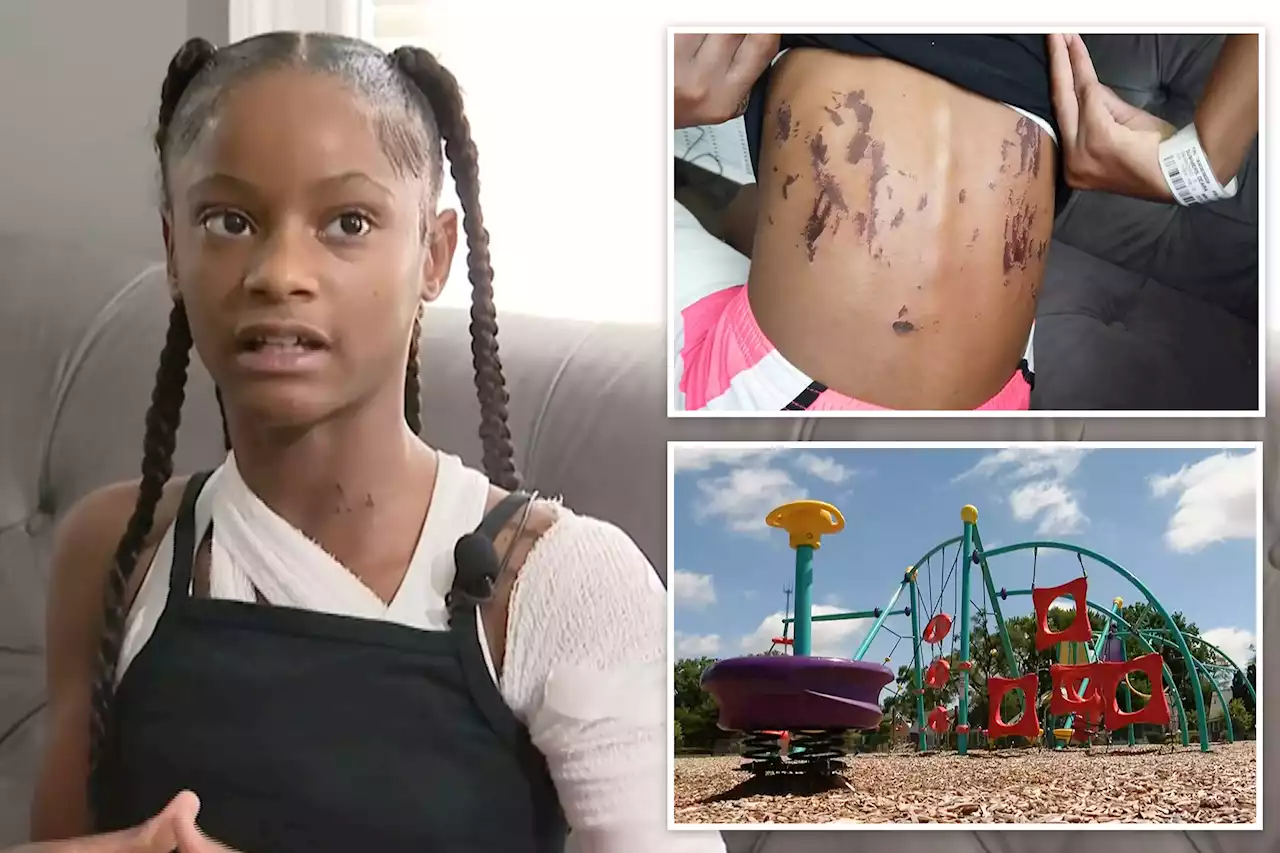 11-year-old girl attacked with acid during playground argument in Detroit