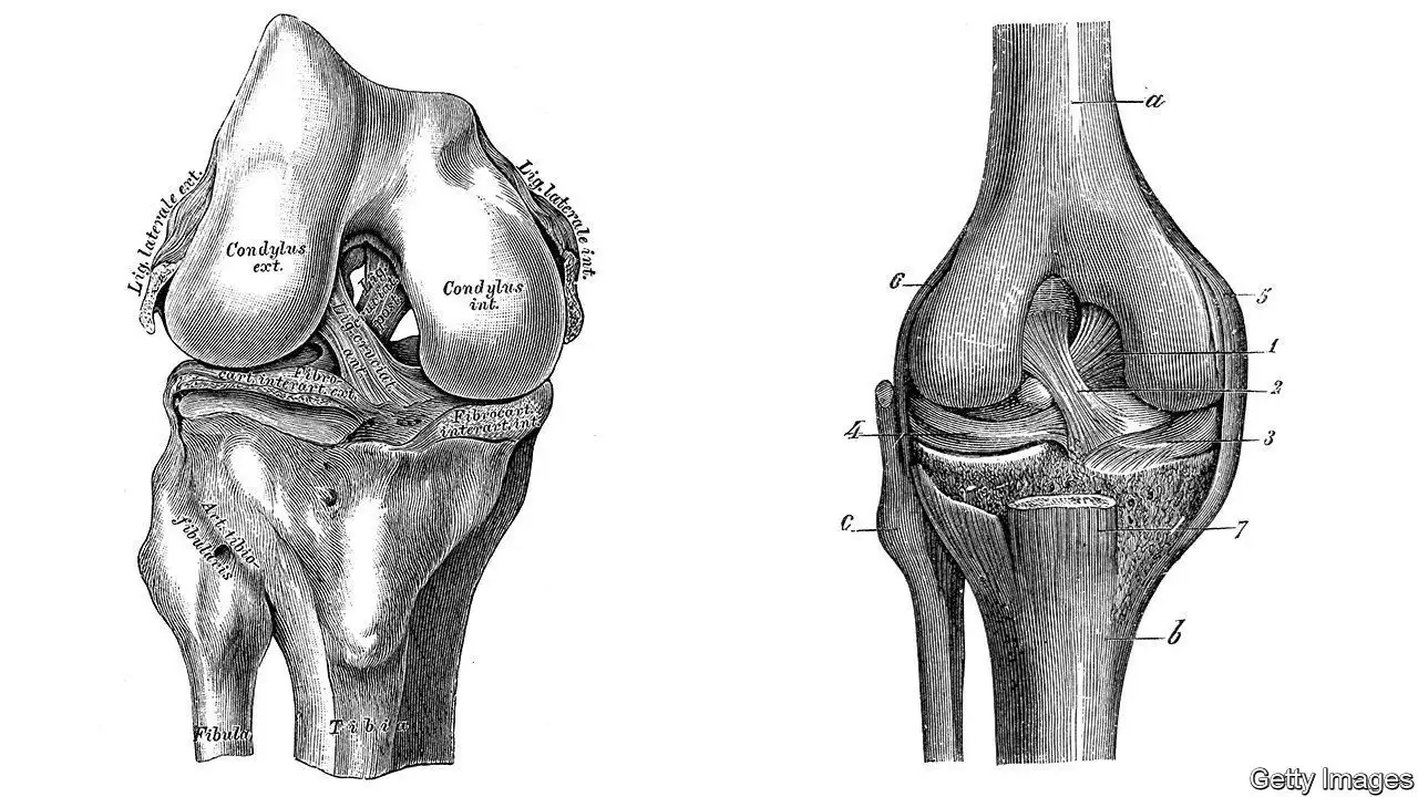 ACL injuries are a growing problem