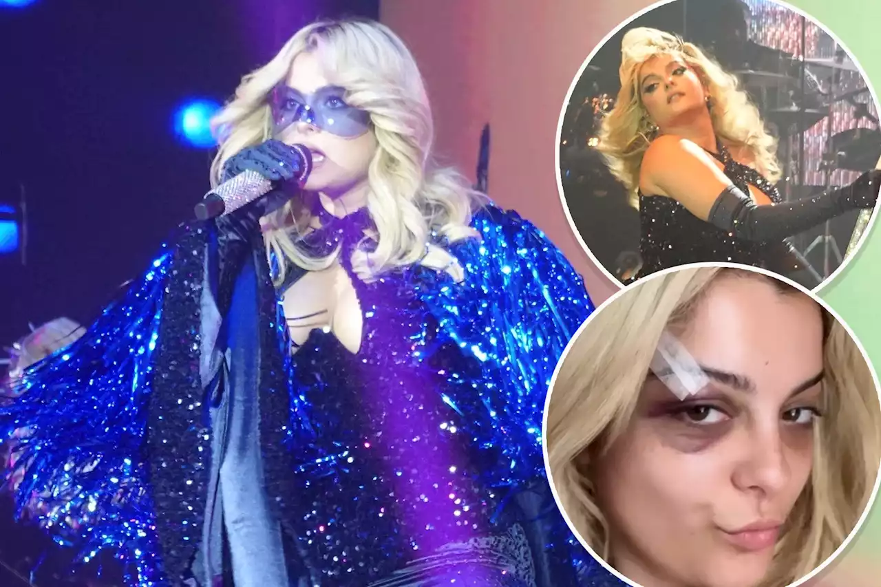 Bebe Rexha wears safety googles during LA performance after being hit with a phone