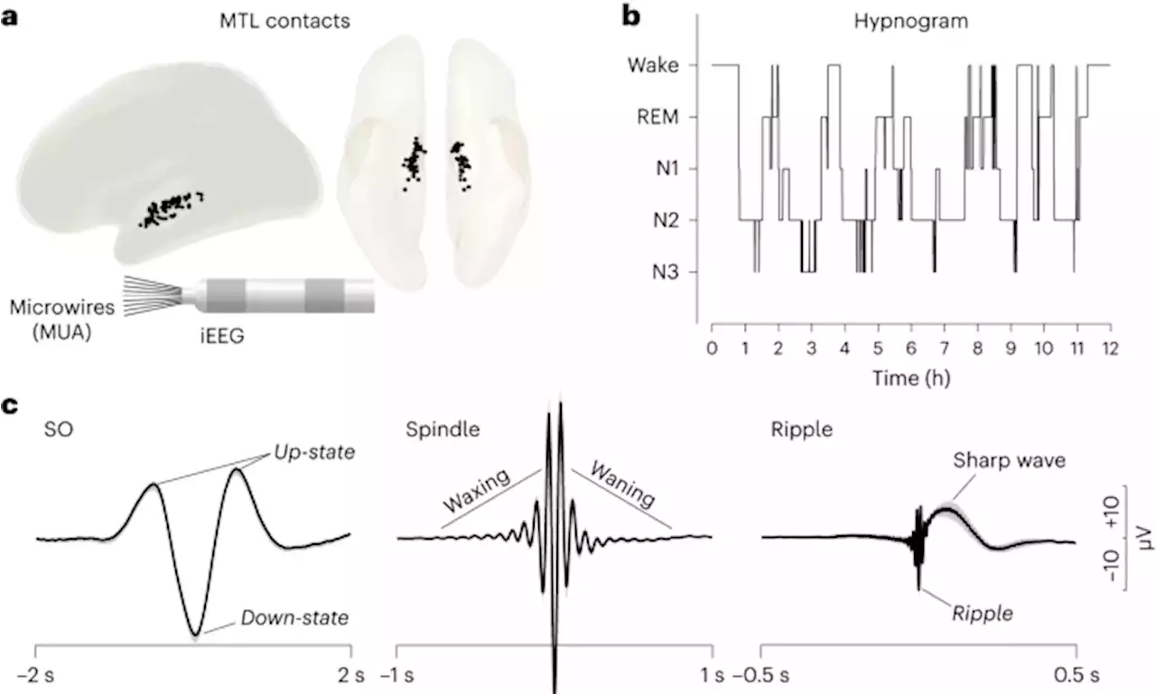 How coupled slow oscillations, spindles and ripples coordinate neuronal processing and communication during human sleep - Nature Neuroscience