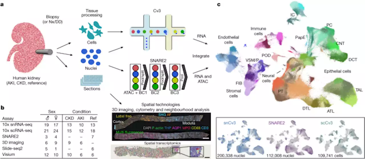 An atlas of healthy and injured cell states and niches in the human kidney - Nature