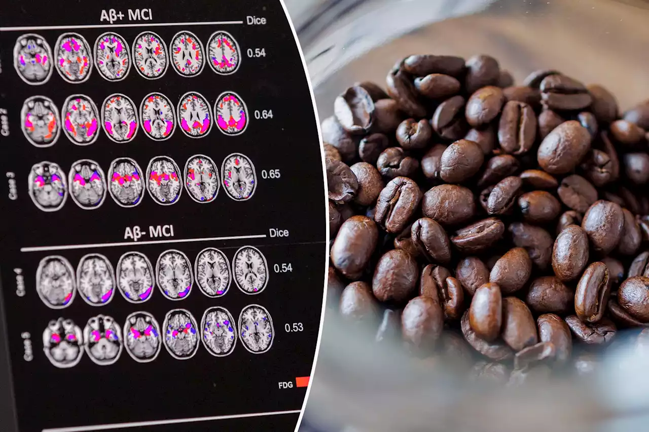 Espresso could save your life someday: new Alzheimer’s research discovery