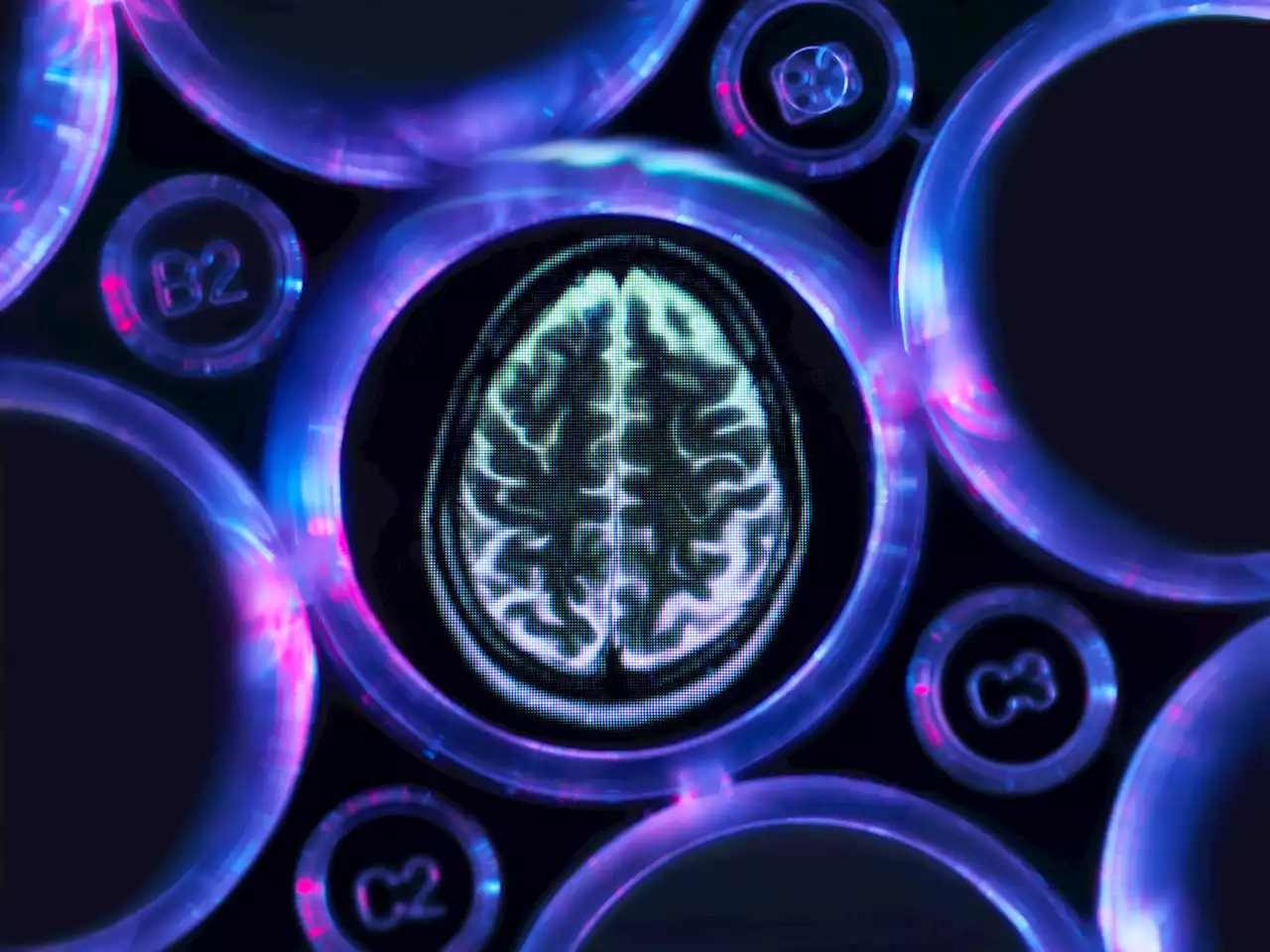 Warning to those who struggle to poo over ‘increased risk of major brain issues'