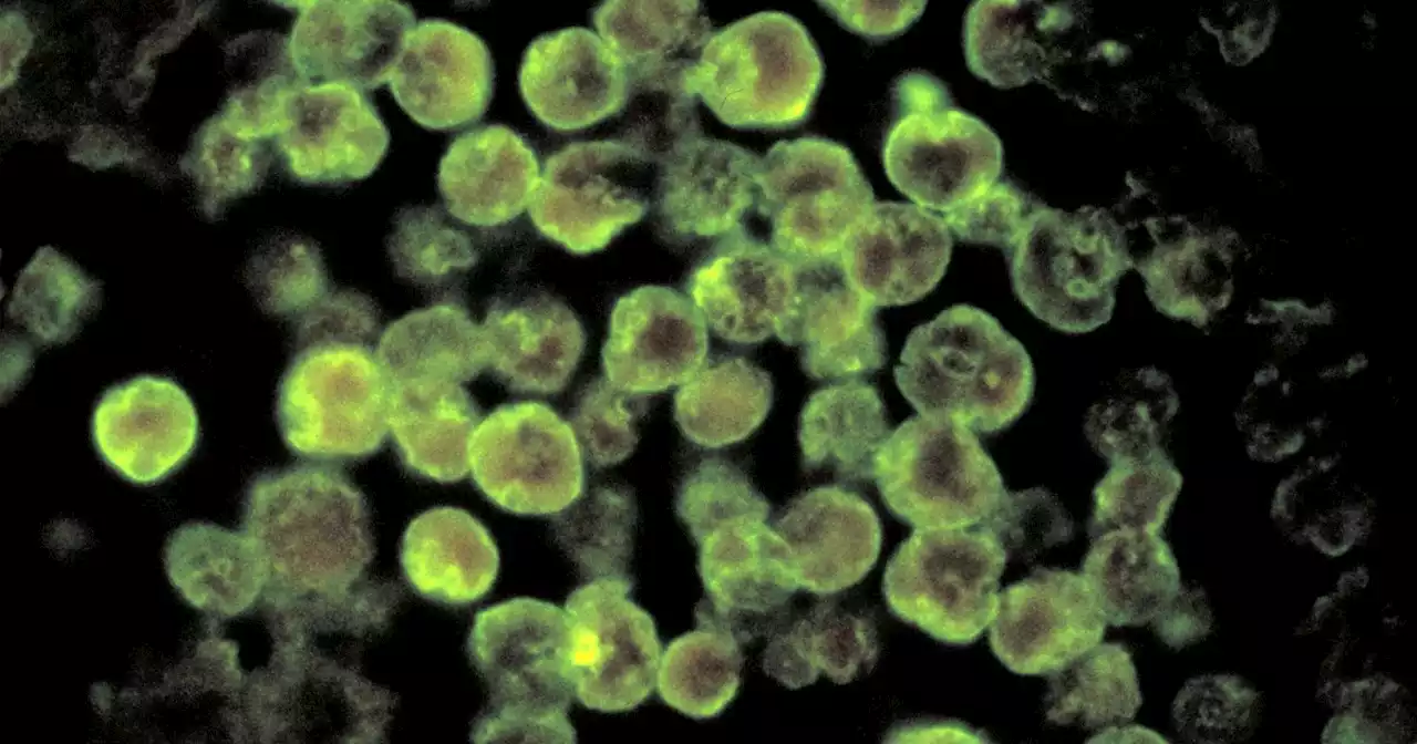 2-year-old boy in Nevada dies from brain-eating amoeba after natural hot spring visit