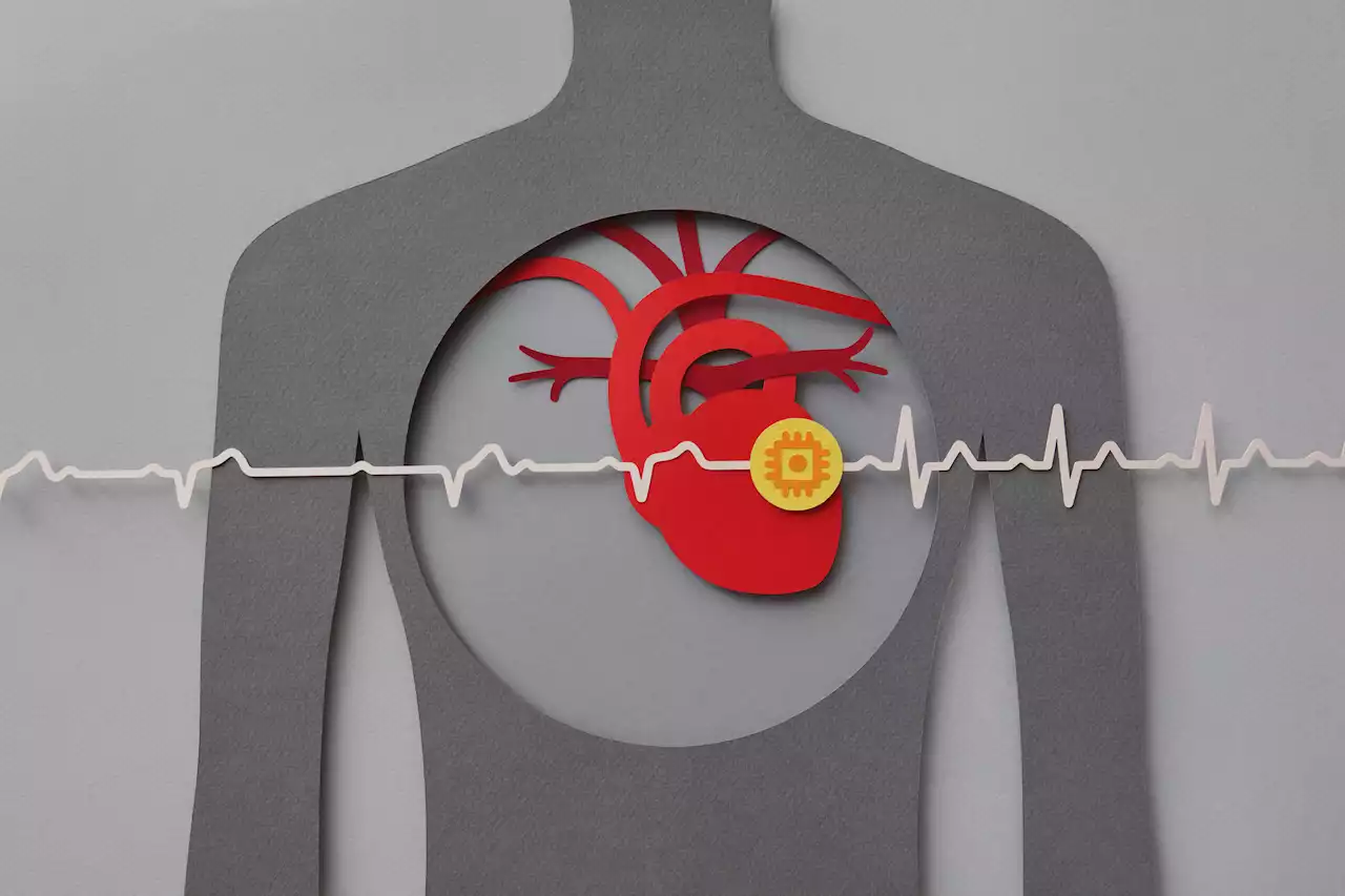 The Diabetes-Heart Arrhythmia Connection