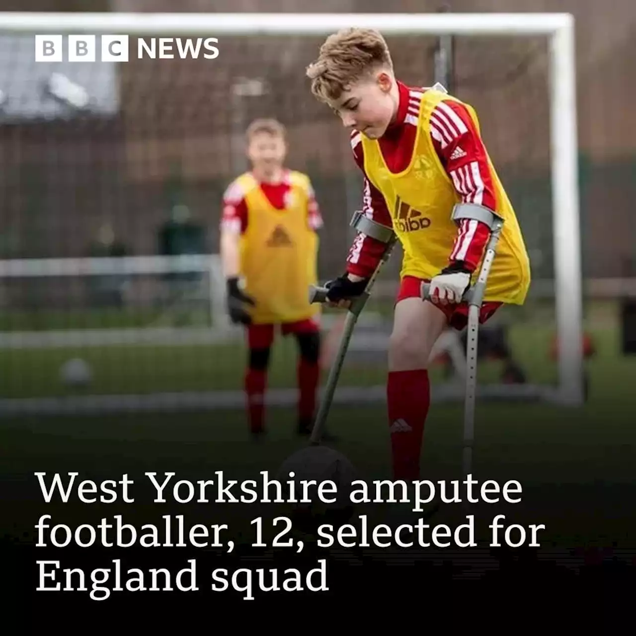 Bradford amputee footballer, 12, selected for England squad