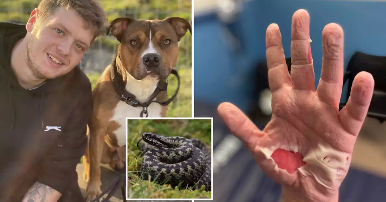 Scots dad bitten by snake hidden in beer bottle spends three nights in hospital