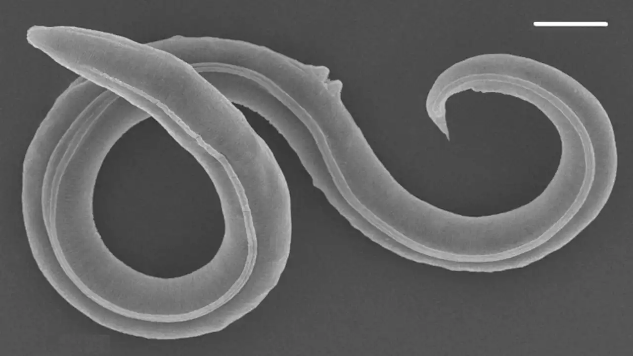 Nematode resurrected from Siberian permafrost laid dormant for 46,000 years