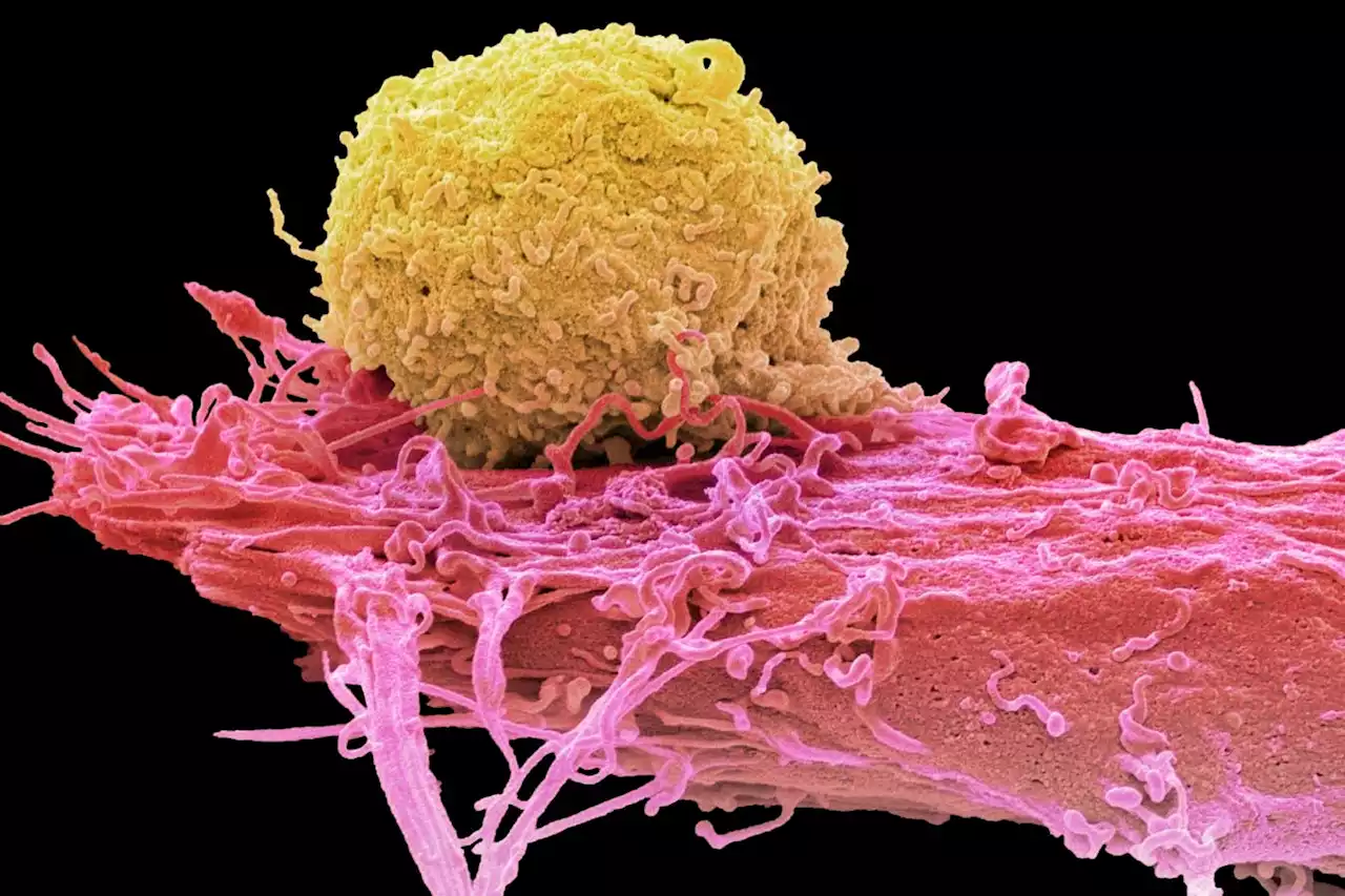 How cancer-fighting immune cells could be made safer and more powerful