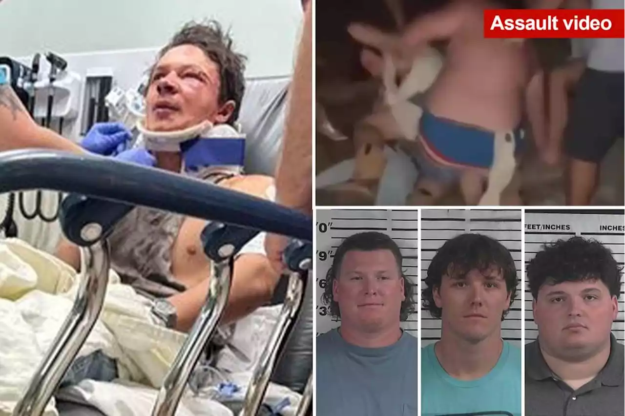 3 men labeled ‘cowards’ are arrested for brutal assault on Alabama teen at music festival that left him unconscious