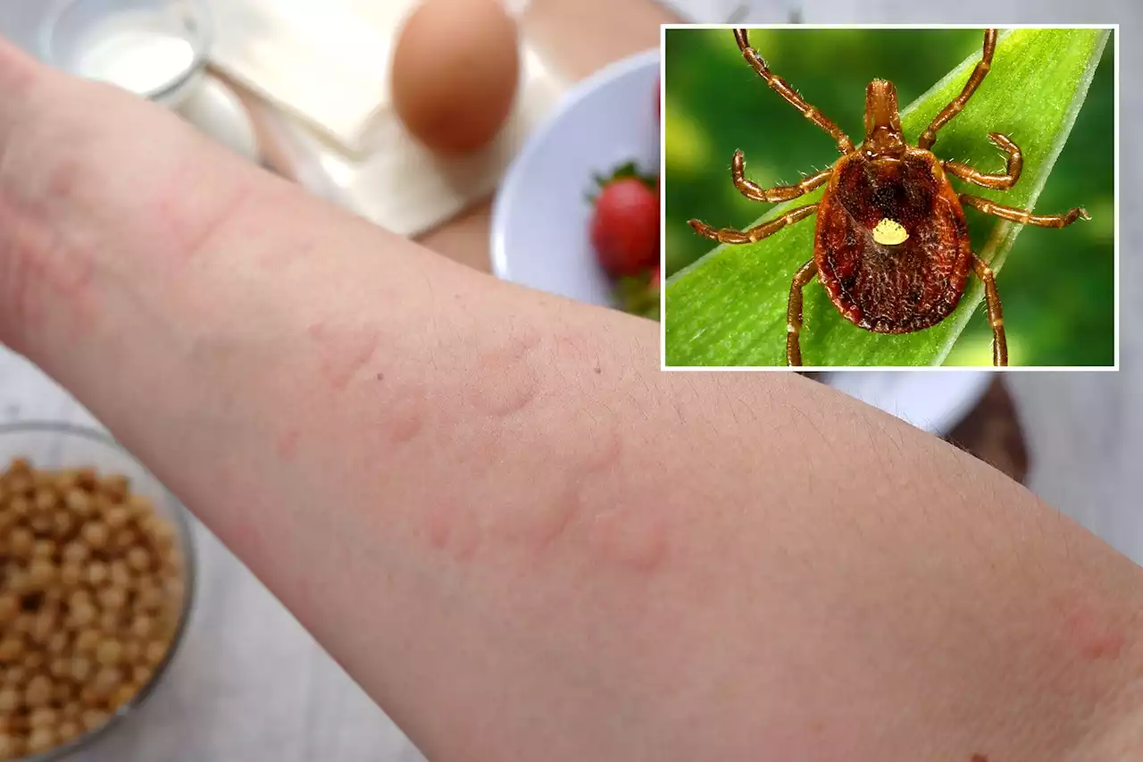 Mysterious illness triggered by tick bite could affect thousands — but many doctors are unaware of it