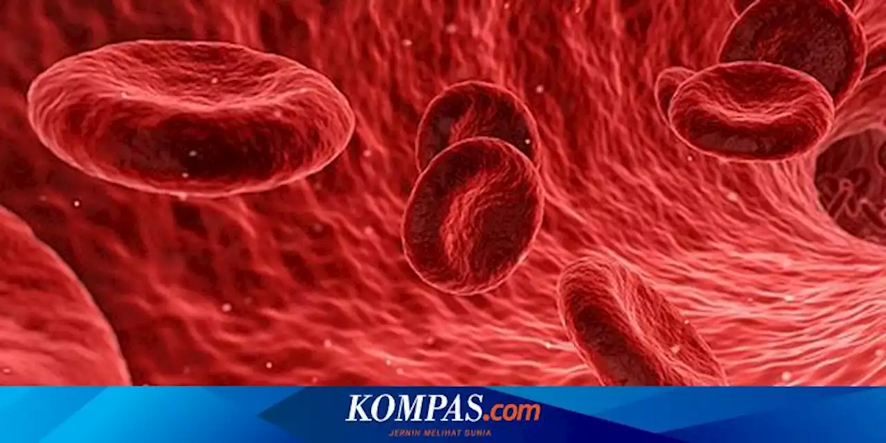 Kenali Apa itu Aneurisma Aorta, Jenis, Penyebab, hingga Gejala