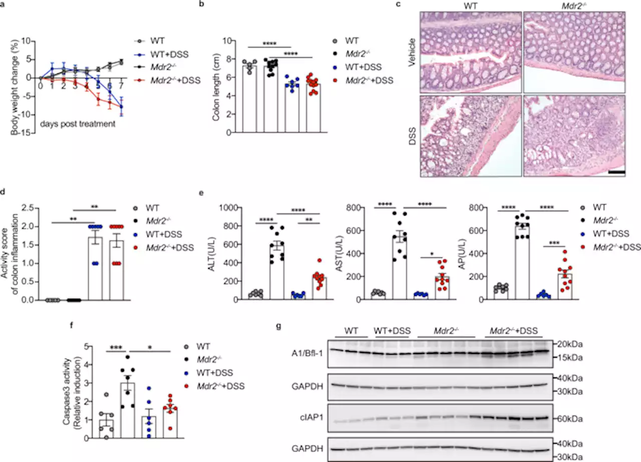 Colitis ameliorates cholestatic liver disease via suppression of bile acid synthesis - Nature Communications