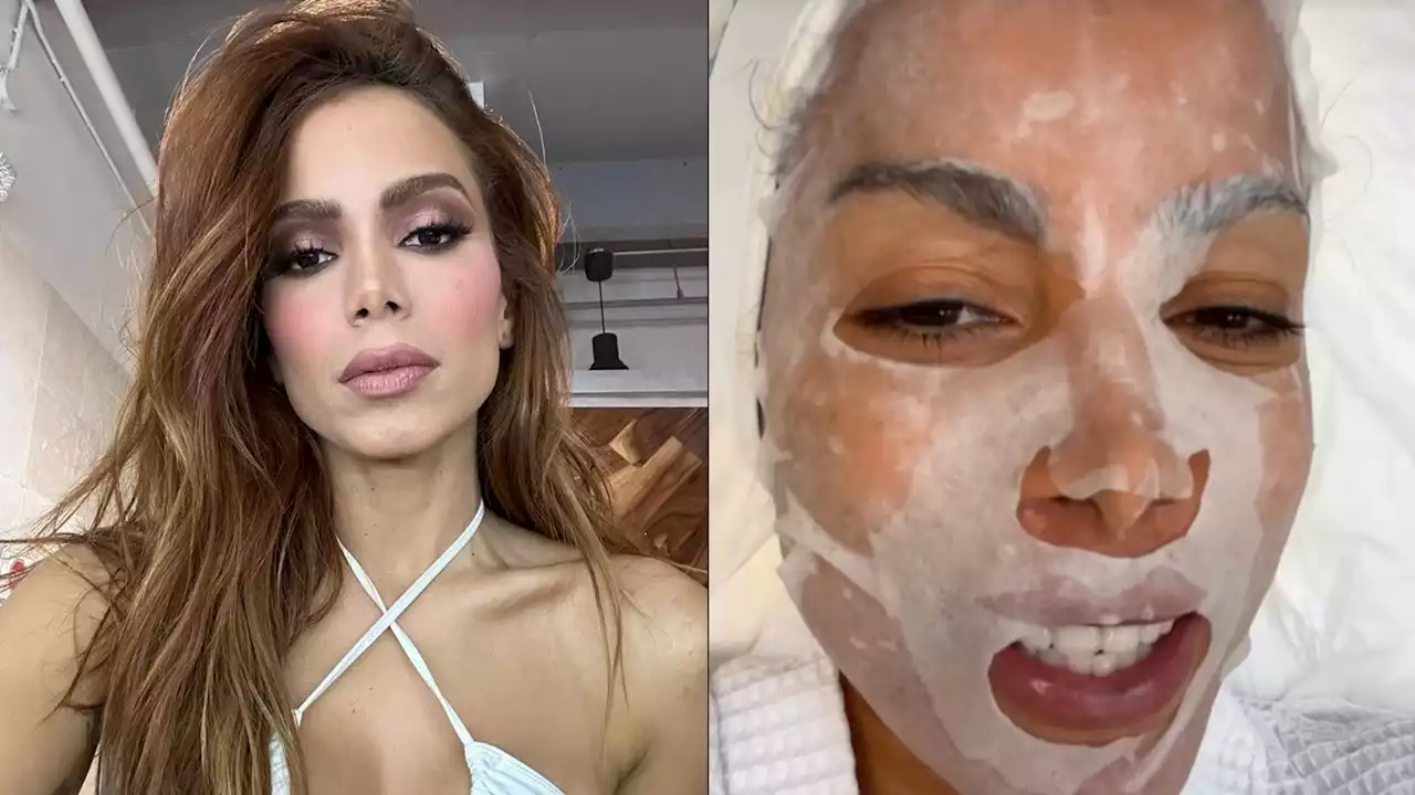 Anitta mostra procedimento com sangue para melhorar a pele íntima e do rosto: ‘Ajuda a rejuvenescer’