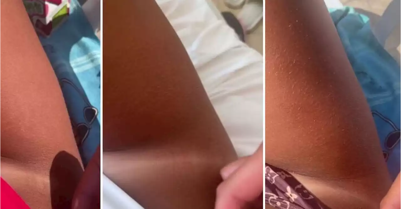 Experts lash use of popular social media sun tanning drug