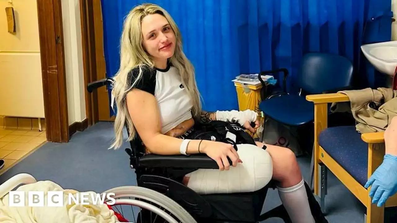 I'm studying nursing after losing my leg to cancer