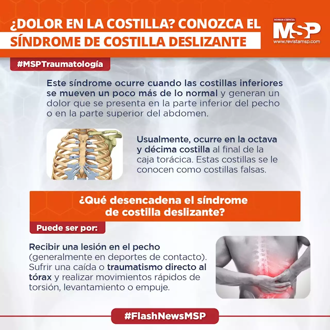 ¿Dolor en la costilla? Conozca el síndrome de costilla deslizante