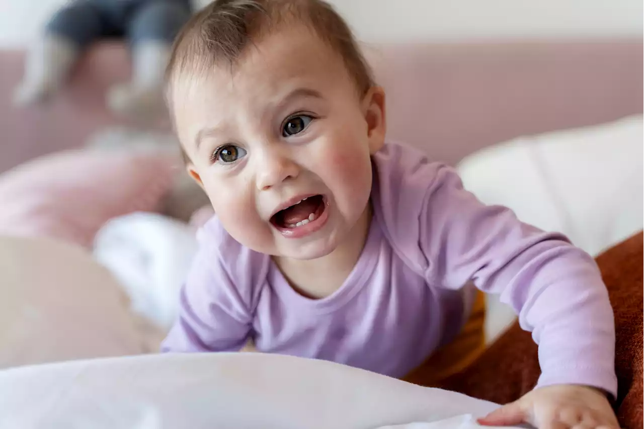 Bebê quase perde parte do pênis por conta de um fio de cabelo