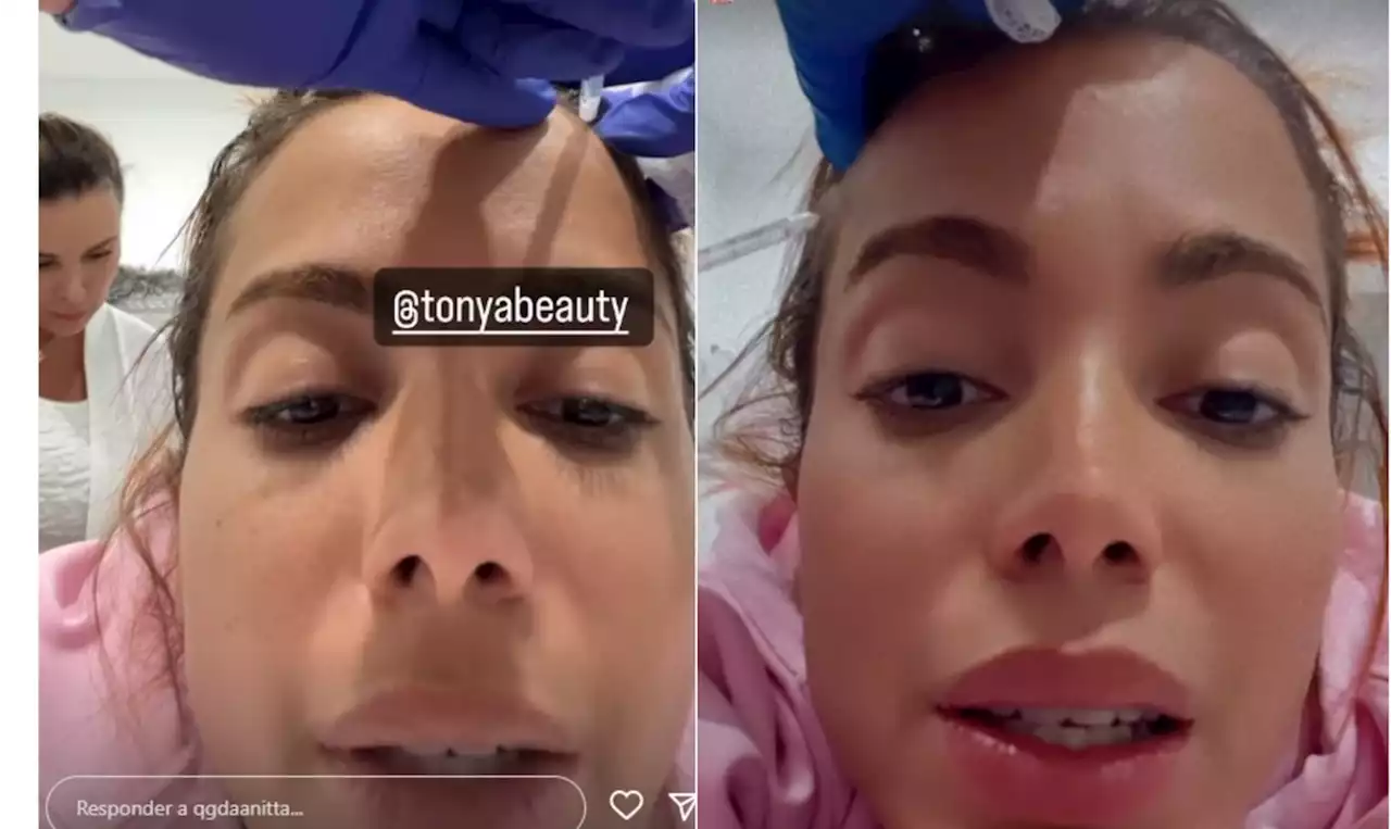 Anitta mostra tratamento estético para crescer cabelo: 'Desde que fiquei doente, dei para ficar meio careca'