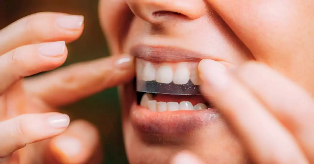 Boots' teeth whitening strips that remove stains slashed to £10 in today's sale