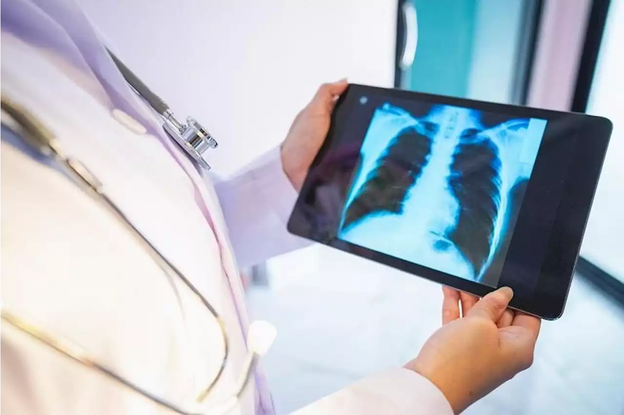 Robotic surgery for lung cancer: Innovative approach may offer shorter recovery time