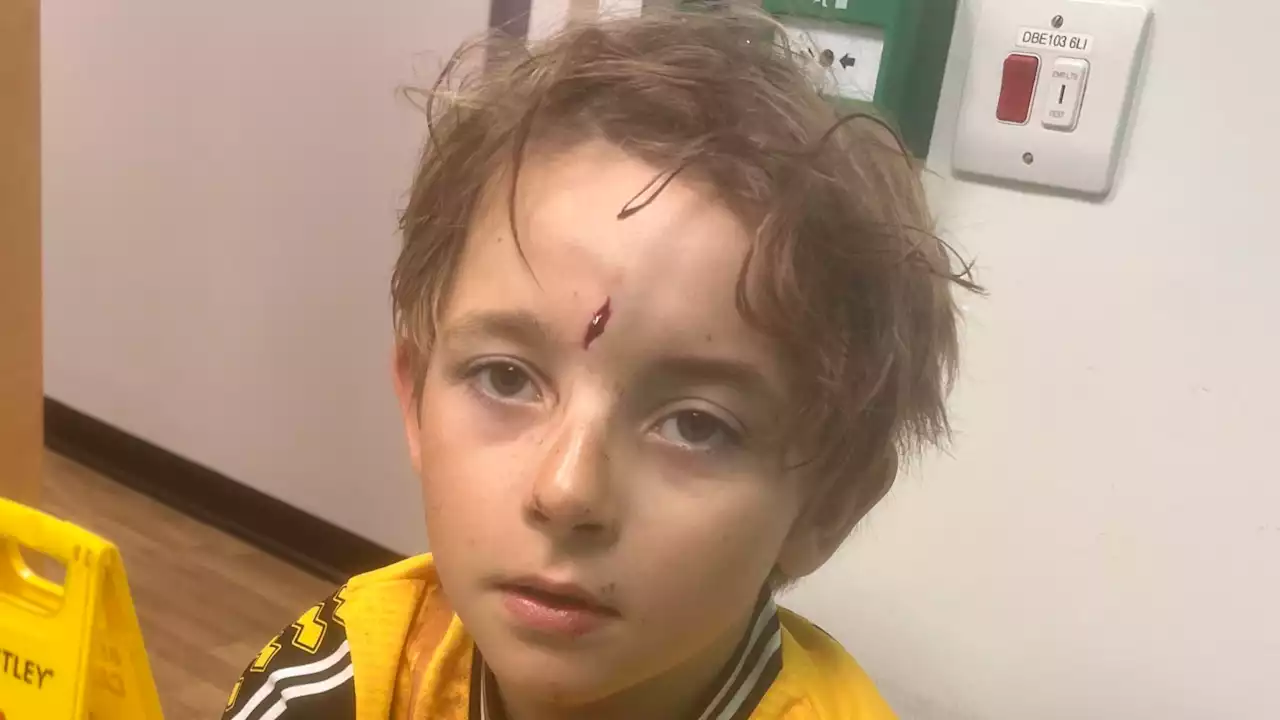 Lincoln mum's warning over helmets after son's cycling injury