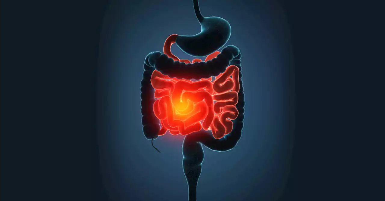 IBD Study Characterizes Biologic Adherence