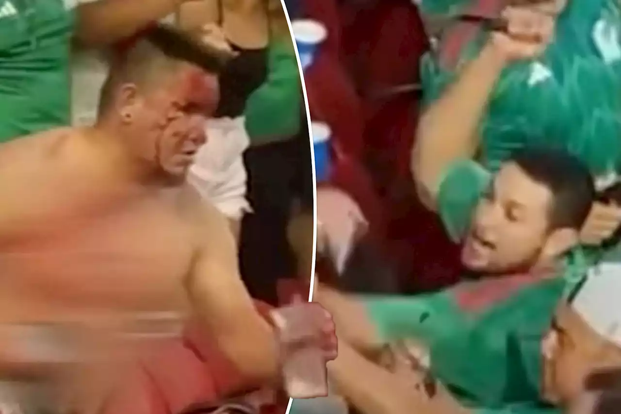 Man stabbed in neck during massive fan brawl at CONCACAF Gold Cup game