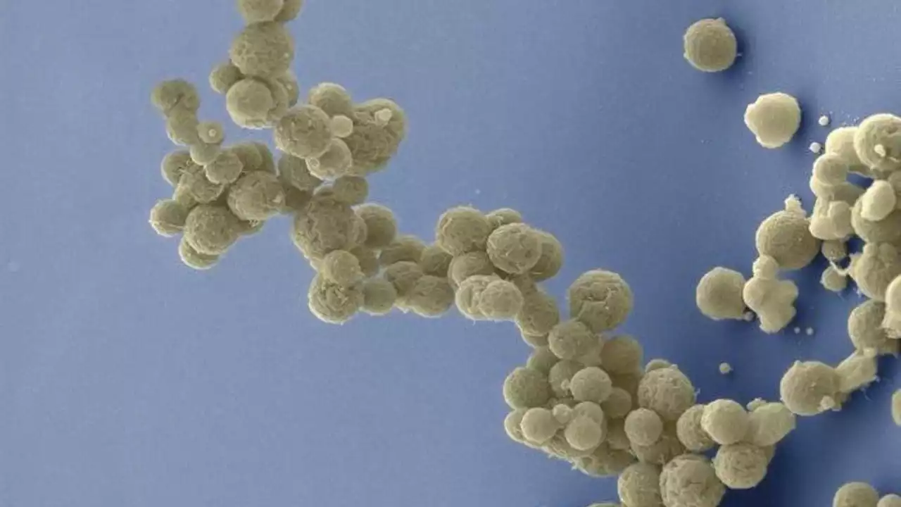 'Life finds a way': Scientists study evolution in synthetic bacteria with limited genes