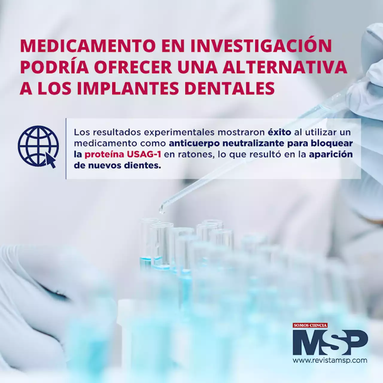 Medicamento en investigación podría ofrecer una alternativa a los implantes dentales