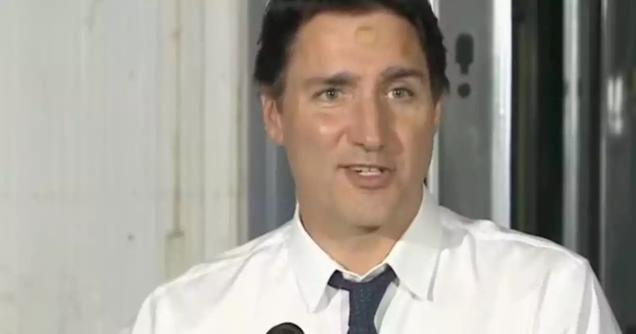 Canadians wonder what happened to Justin Trudeau's forehead